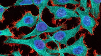 Плитка шоколада поможет обнаружить раковые клетки