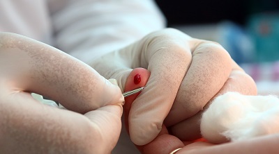 Онкогематологические заболевания - не приговор