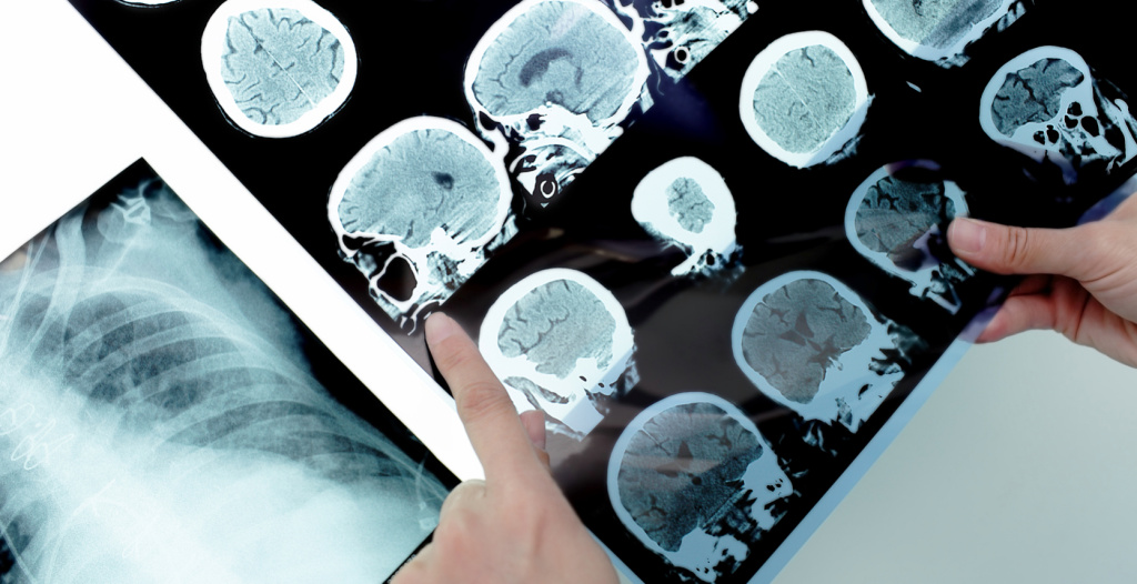 Московские клиники проверят на рак