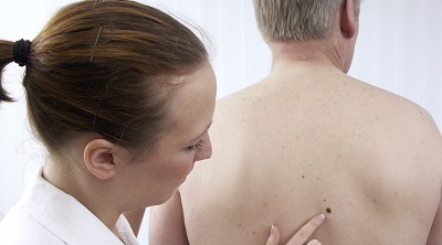 25 мая - День диагностики меланомы