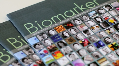 Биомаркер даст прогноз эффективности химиотерапии при остеосаркоме