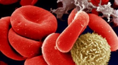 Разработан микрочип для диагностики опухолей крови