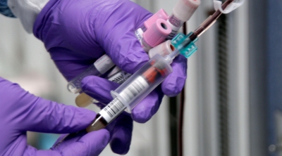 В Гарварде создано устройство, способное выделять раковые клетки из крови