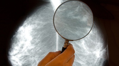 Лечение рака на ранней стадии - залог успеха