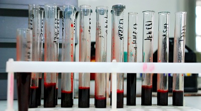 В США новорожденную девочку полностью излечили от ВИЧ