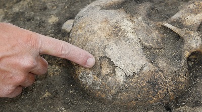 Учёные обнаружили одно из самых ранних свидетельств заболевания раком у древних людей