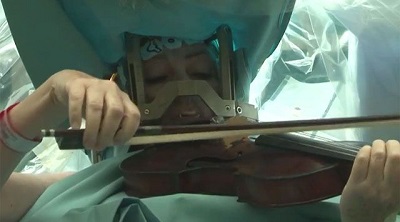 Пациентка во время операции на мозге играла на скрипке