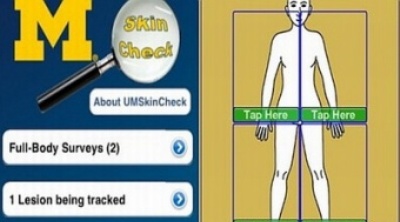 Диагностировать рак кожи можно с помощью мобильного приложения