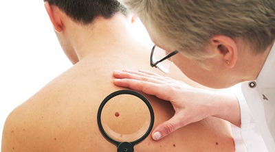 В московской больнице установлен аппарат для безоперационного лечения рака кожи