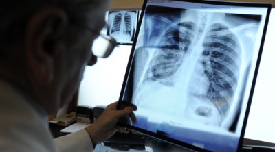 В Челябинской области суд закрыл рентгенкабинет для тяжелобольных