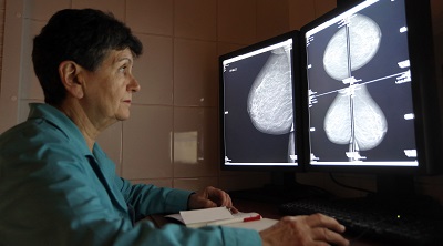 3D-скрининг рака груди обнаруживает заболевание на 40% чаще