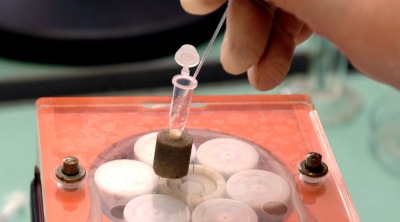 Ферменты восстанавливают поврежденные ткани кишечника, предотвращая рак