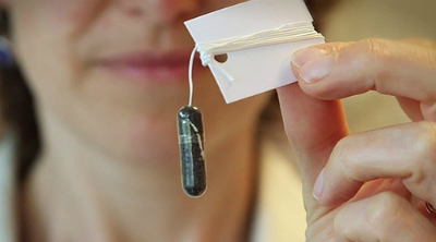 Капсула на нитке заменит биопсию для диагностики рака пищевода